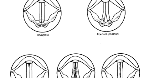 Humano vocales cuantas cuerdas ser tiene el